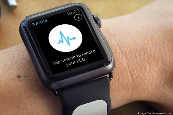 Alivecor Kardia Band